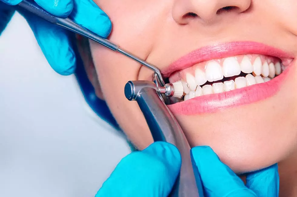 Discovering the Wonders of Dental Extraction NYC