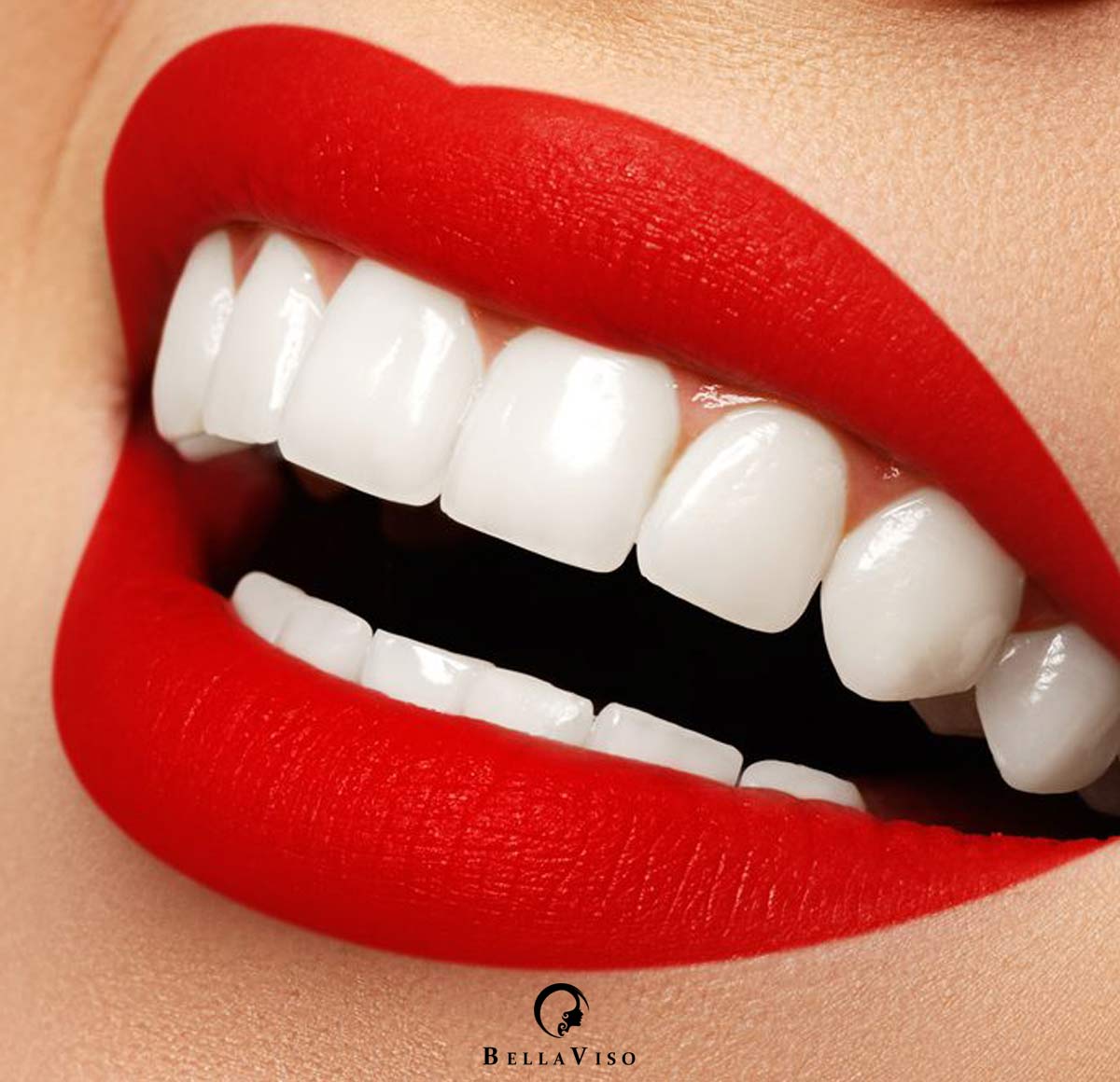 Transform Your Smile: Discover the Top Rated Dental Veneers in Dubai