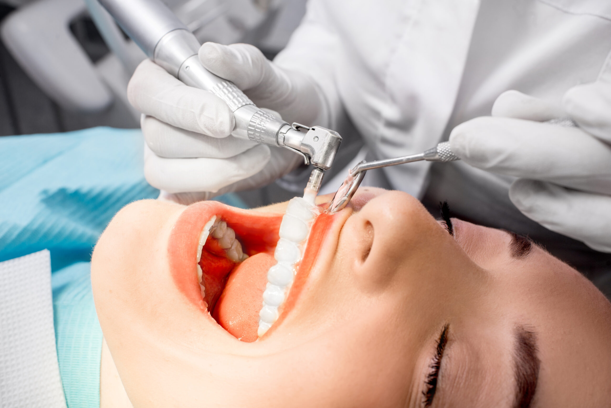 “Finding Same Day Emergency Dentist Services in Houston, TX”