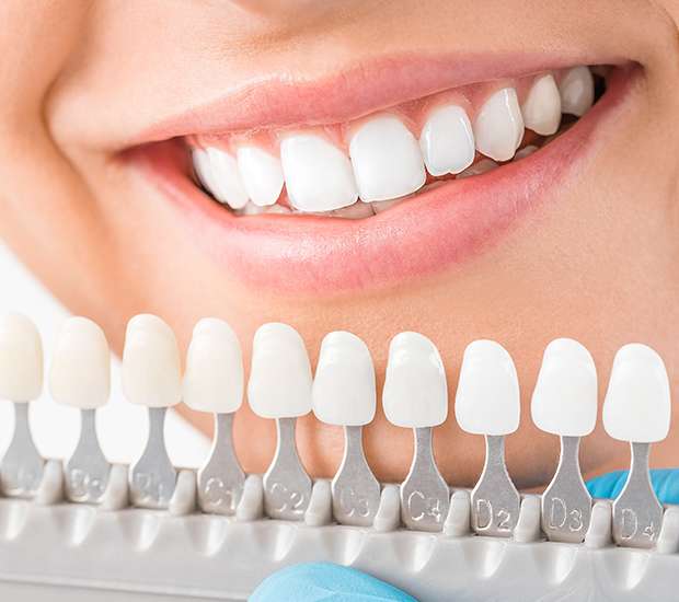 Looking For Dental Crowns Near Me? Why A Periodontist In Manhattan Could Be Your Best Choice!