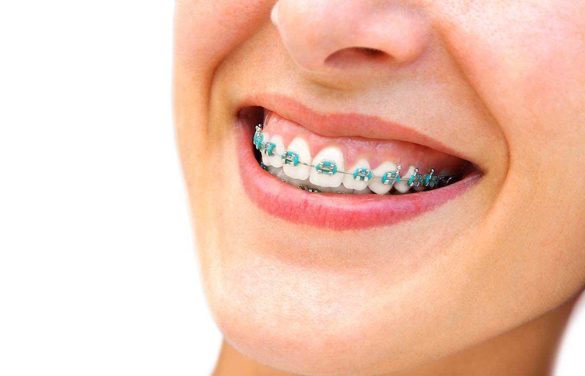 How Do Teeth Cleaning In Miami Differ From Orthodontist Services In Aventura, Florida?
