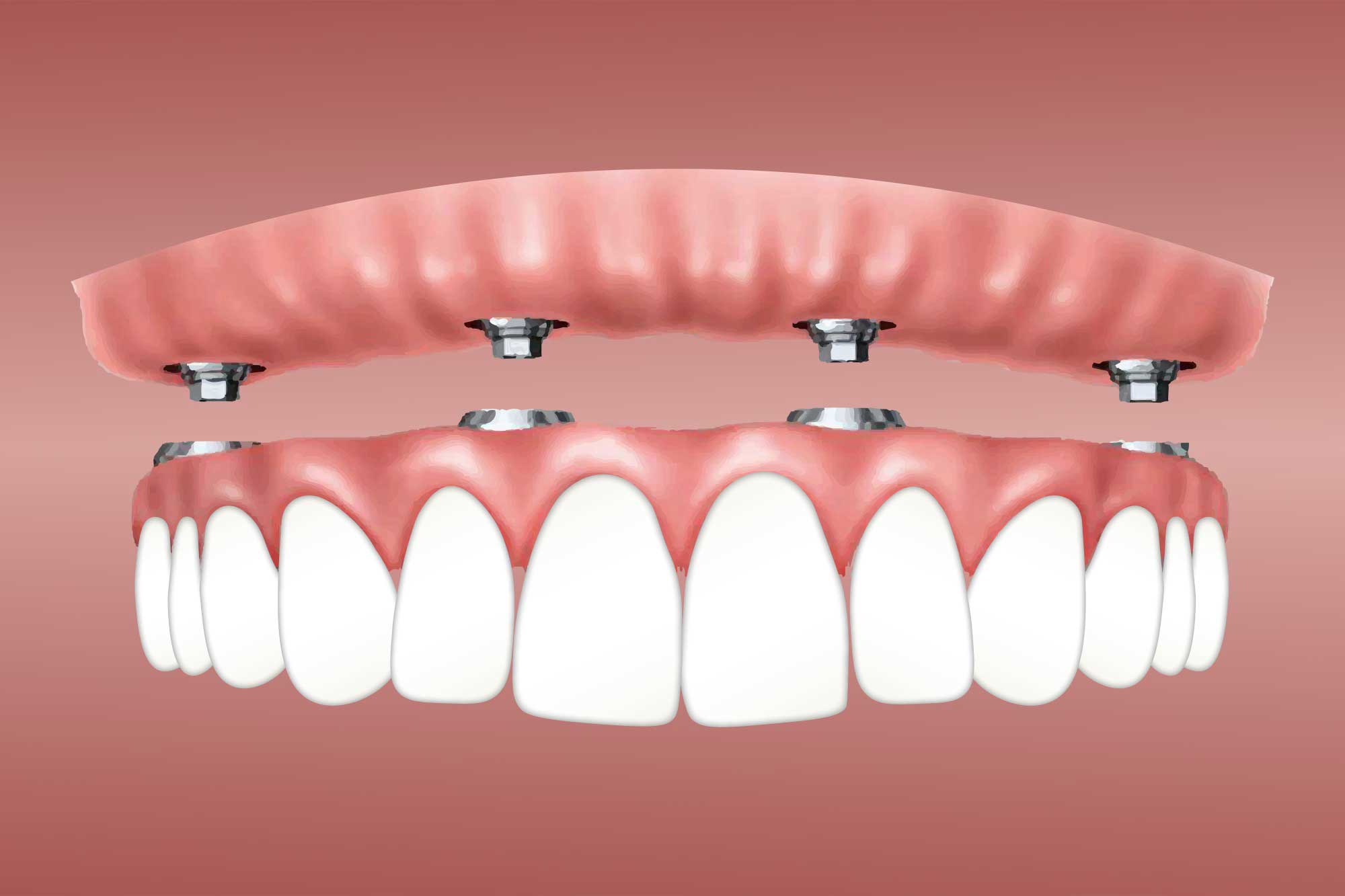 What Are The Latest Advancements In Orthodontic Treatments Offered In Singapore?
